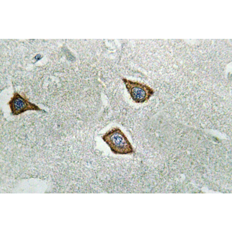 Immunohistochemistry - Anti-Calpain 2 Antibody (R12-2051) - Antibodies.com