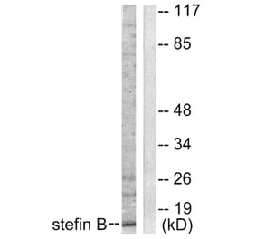Western Blot - Anti-Stefin B Antibody (C0330) - Antibodies.com