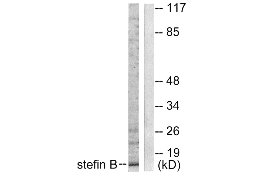 Western Blot - Anti-Stefin B Antibody (C0330) - Antibodies.com