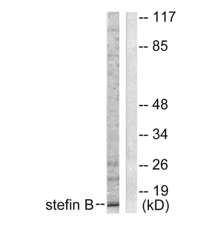 Western Blot - Anti-Stefin B Antibody (C0330) - Antibodies.com