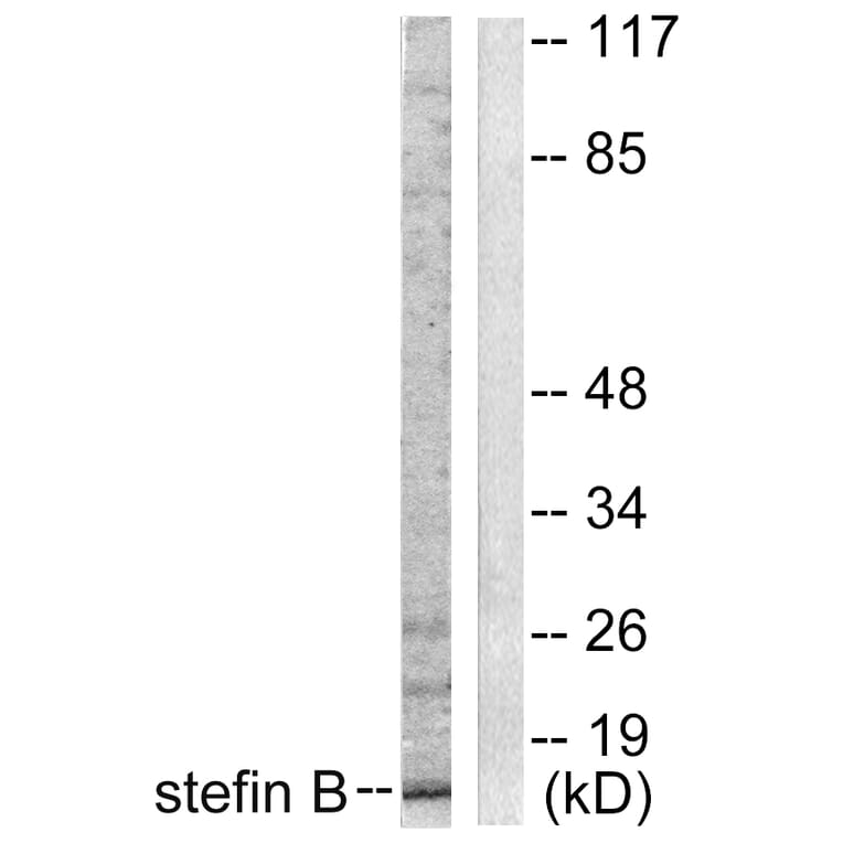 Western Blot - Anti-Stefin B Antibody (C0330) - Antibodies.com