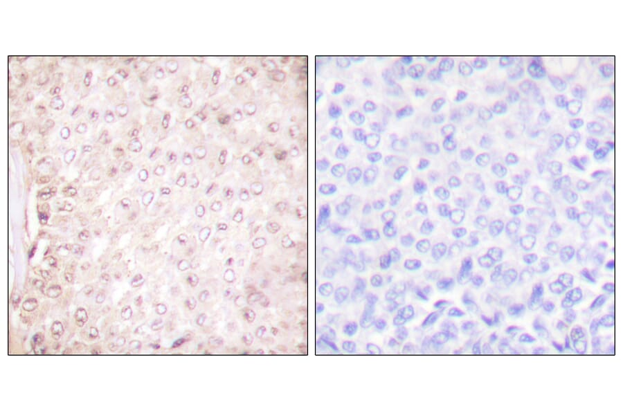 Immunohistochemistry - Anti-Stefin B Antibody (C0330) - Antibodies.com