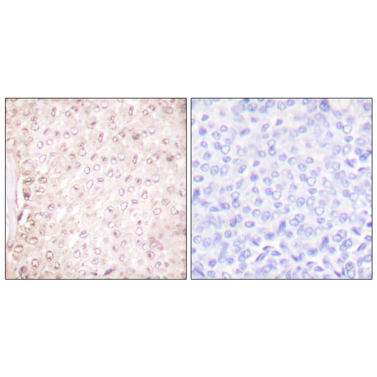 Immunohistochemistry - Anti-Stefin B Antibody (C0330) - Antibodies.com