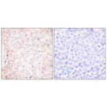Immunohistochemistry - Anti-Stefin B Antibody (C0330) - Antibodies.com