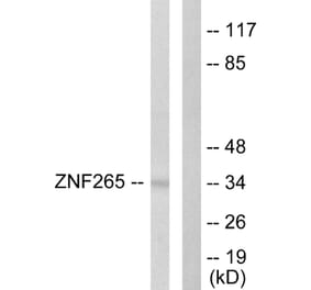 Western Blot - Anti-ZNF265 Antibody (C10218) - Antibodies.com