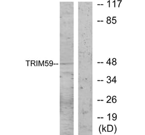 Western Blot - Anti-TRIM59 Antibody (C11314) - Antibodies.com