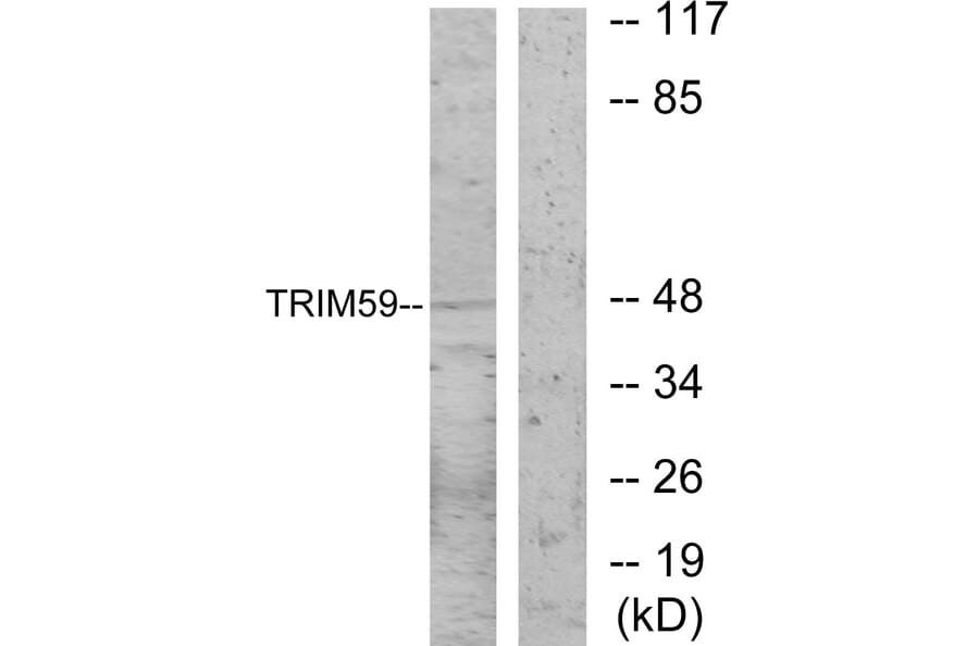 Western Blot - Anti-TRIM59 Antibody (C11314) - Antibodies.com