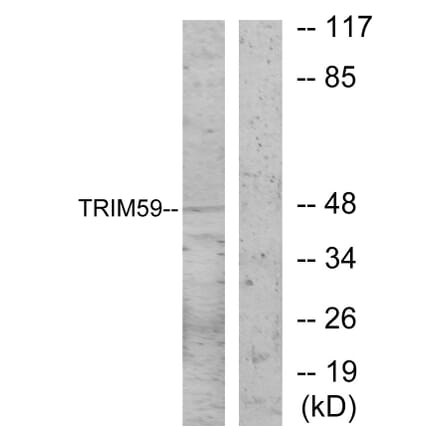 Western Blot - Anti-TRIM59 Antibody (C11314) - Antibodies.com
