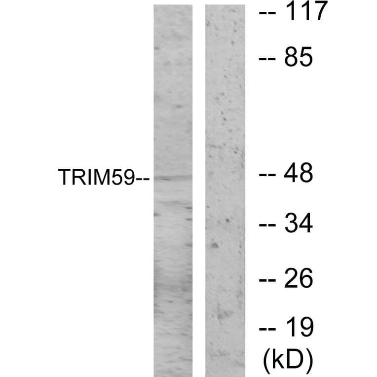 Western Blot - Anti-TRIM59 Antibody (C11314) - Antibodies.com