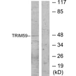 Western Blot - Anti-TRIM59 Antibody (C11314) - Antibodies.com