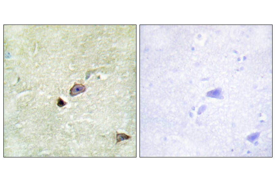 Immunohistochemistry - Anti-TRIM59 Antibody (C11314) - Antibodies.com