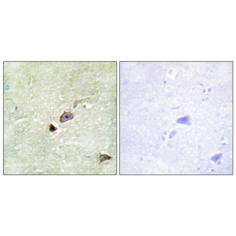 Immunohistochemistry - Anti-TRIM59 Antibody (C11314) - Antibodies.com
