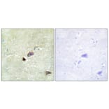 Immunohistochemistry - Anti-TRIM59 Antibody (C11314) - Antibodies.com