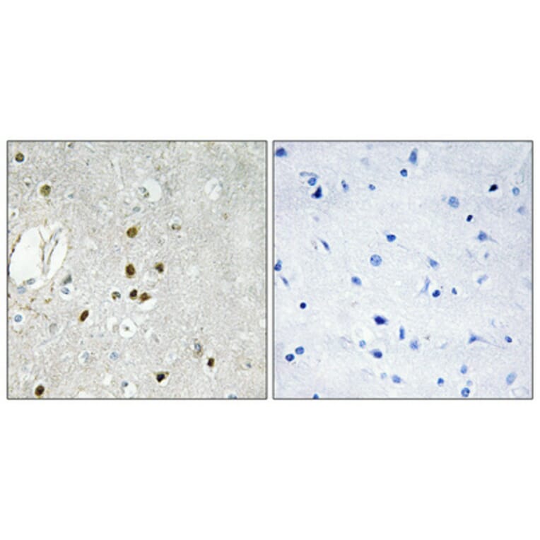 Immunohistochemistry - Anti-RPL27A Antibody (C14165) - Antibodies.com