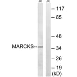 Western Blot - Anti-MARCKS Antibody (B7142) - Antibodies.com