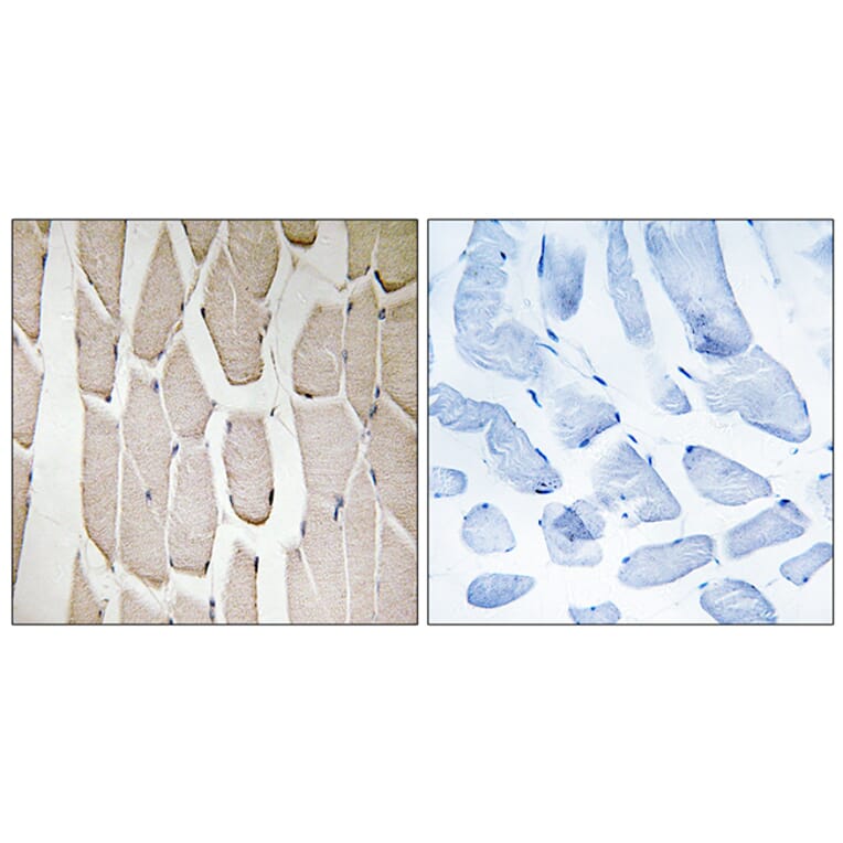 Immunohistochemistry - Anti-MARCH3 Antibody (C15548) - Antibodies.com