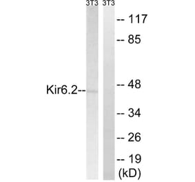 Western Blot - Anti-Kir6.2 Antibody (B1084) - Antibodies.com
