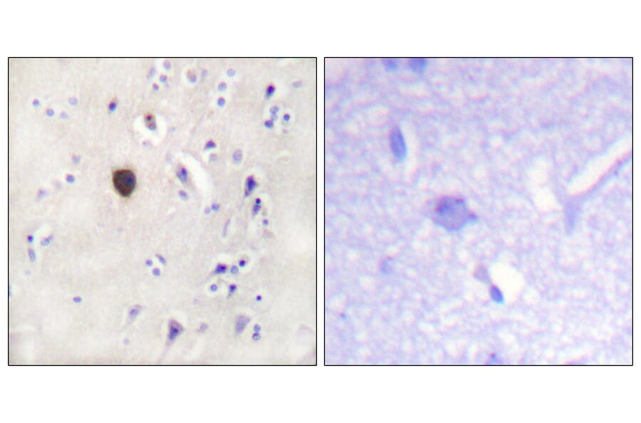 Immunohistochemistry - Anti-Kir6.2 Antibody (B1084) - Antibodies.com