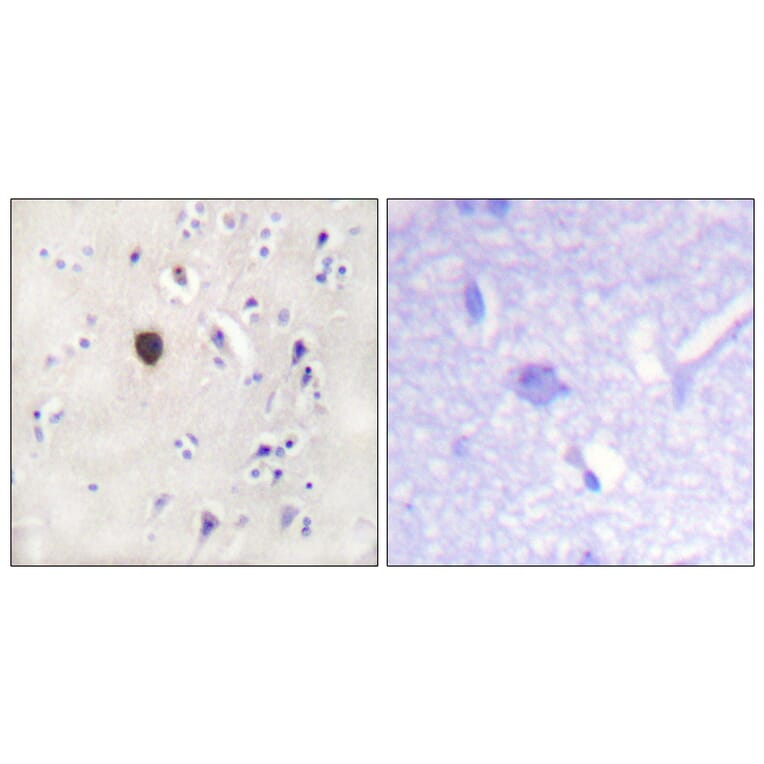Immunohistochemistry - Anti-Kir6.2 Antibody (B1084) - Antibodies.com