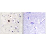 Immunohistochemistry - Anti-Kir6.2 Antibody (B1084) - Antibodies.com