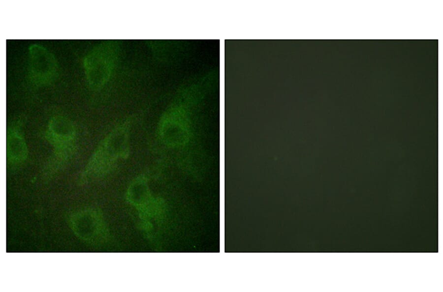 Immunofluorescence - Anti-Kir6.2 Antibody (B1084) - Antibodies.com