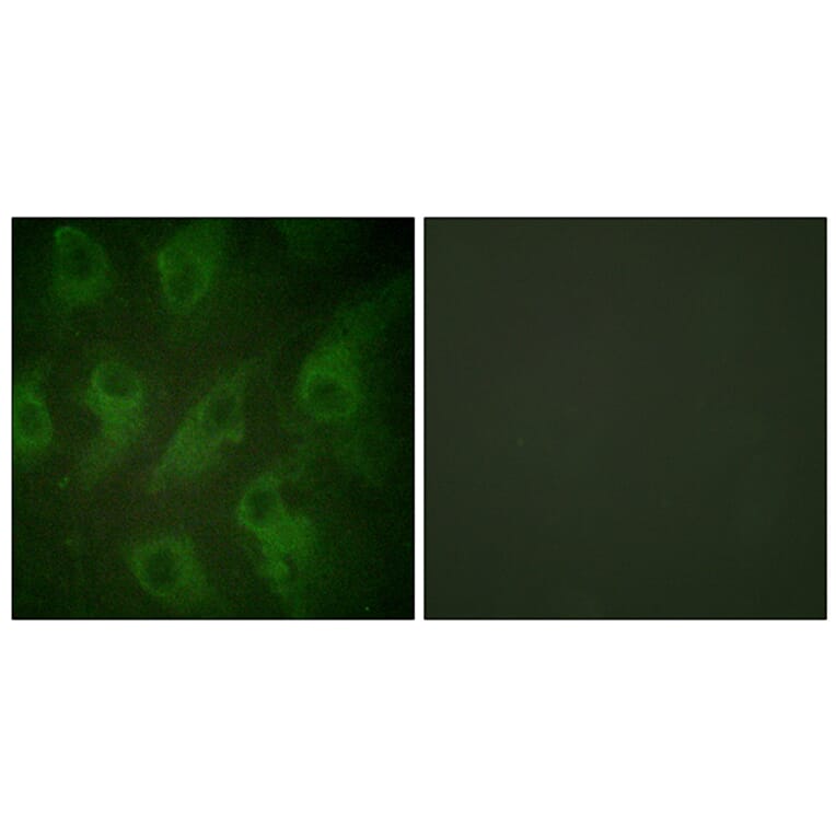 Immunofluorescence - Anti-Kir6.2 Antibody (B1084) - Antibodies.com