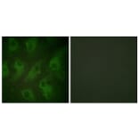 Immunofluorescence - Anti-Kir6.2 Antibody (B1084) - Antibodies.com