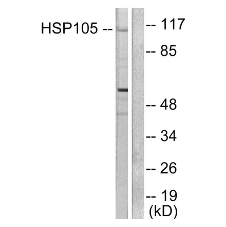 Western Blot - Anti-HSP105 Antibody (C0231) - Antibodies.com