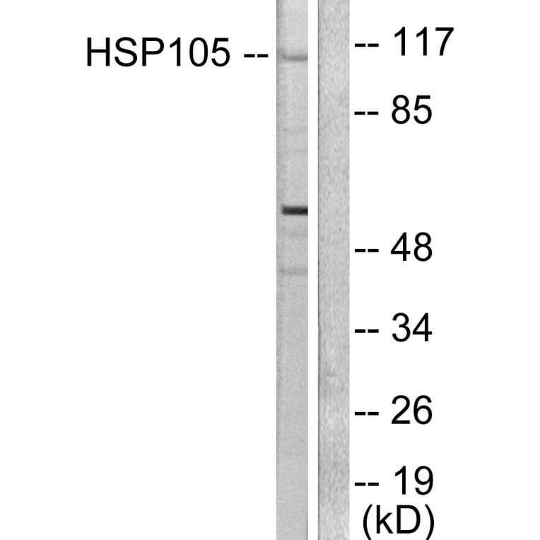 Western Blot - Anti-HSP105 Antibody (C0231) - Antibodies.com