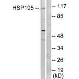 Western Blot - Anti-HSP105 Antibody (C0231) - Antibodies.com