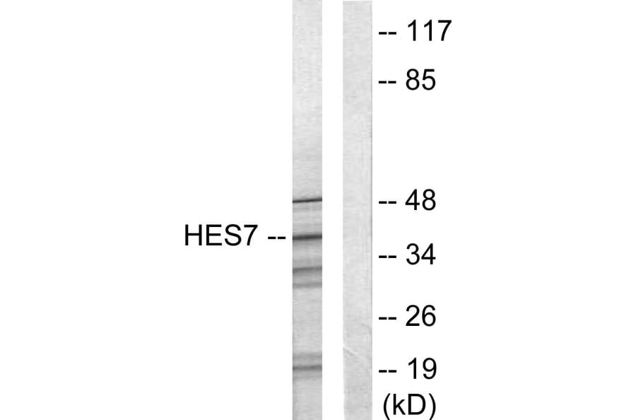 Western Blot - Anti-HEXIM1 Antibody (C10210) - Antibodies.com