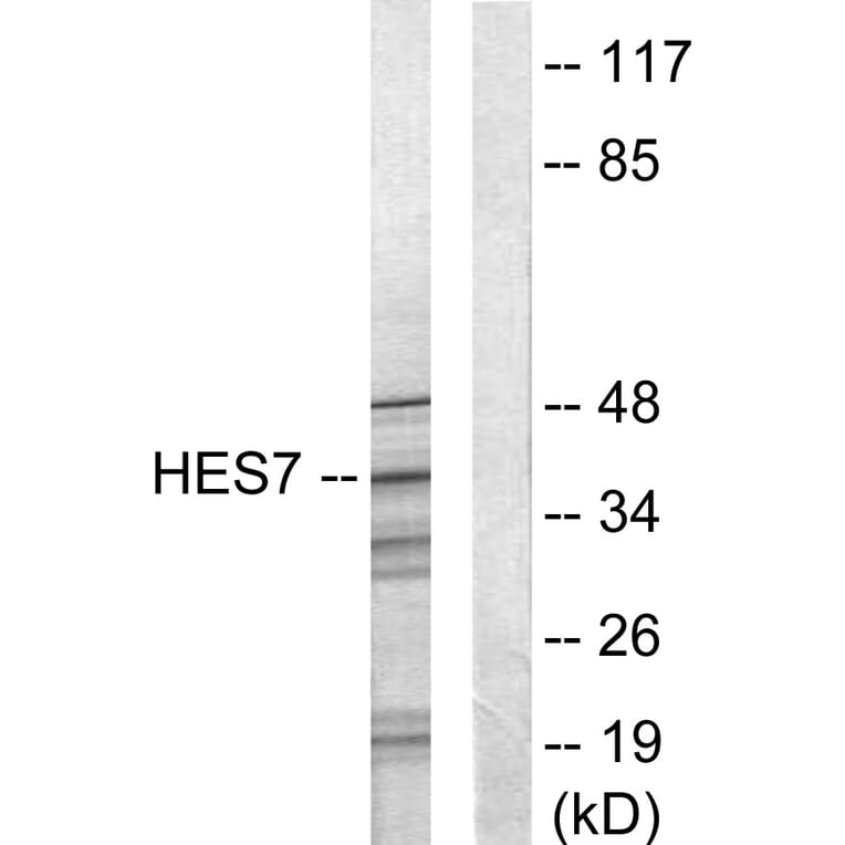 Western Blot - Anti-HEXIM1 Antibody (C10210) - Antibodies.com