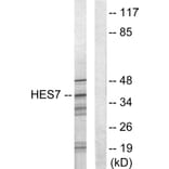 Western Blot - Anti-HEXIM1 Antibody (C10210) - Antibodies.com