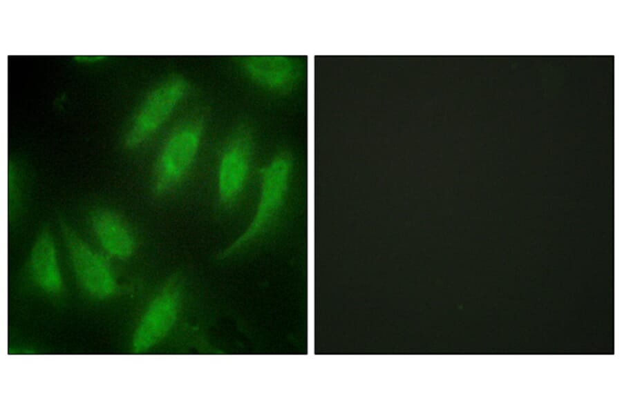 Immunofluorescence - Anti-HEXIM1 Antibody (C10210) - Antibodies.com