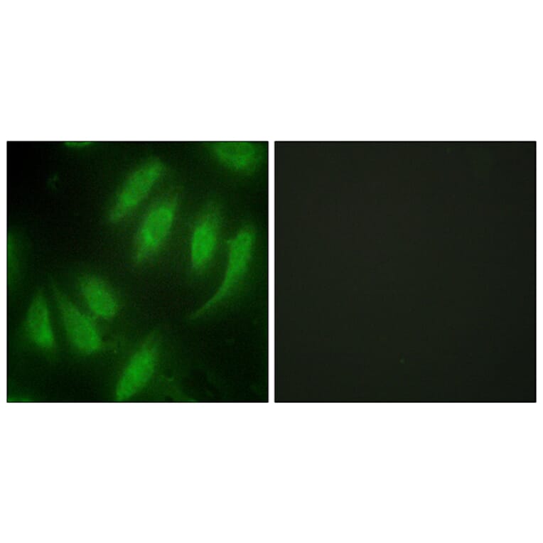 Immunofluorescence - Anti-HEXIM1 Antibody (C10210) - Antibodies.com