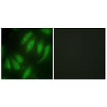 Immunofluorescence - Anti-HEXIM1 Antibody (C10210) - Antibodies.com