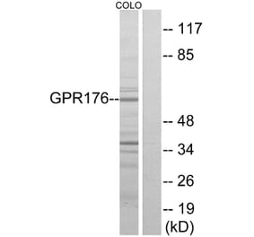 Western Blot - Anti-GPR176 Antibody (G115) - Antibodies.com