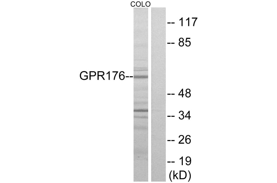 Western Blot - Anti-GPR176 Antibody (G115) - Antibodies.com