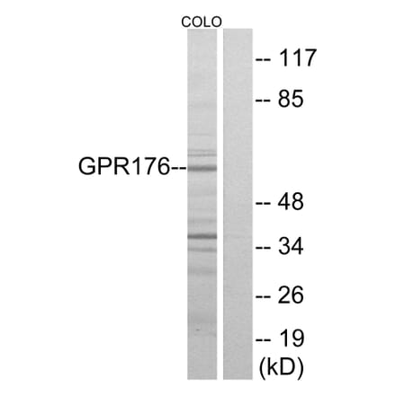 Western Blot - Anti-GPR176 Antibody (G115) - Antibodies.com