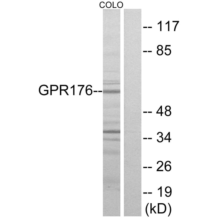 Western Blot - Anti-GPR176 Antibody (G115) - Antibodies.com