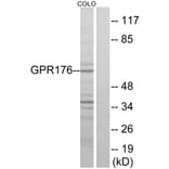 Western Blot - Anti-GPR176 Antibody (G115) - Antibodies.com
