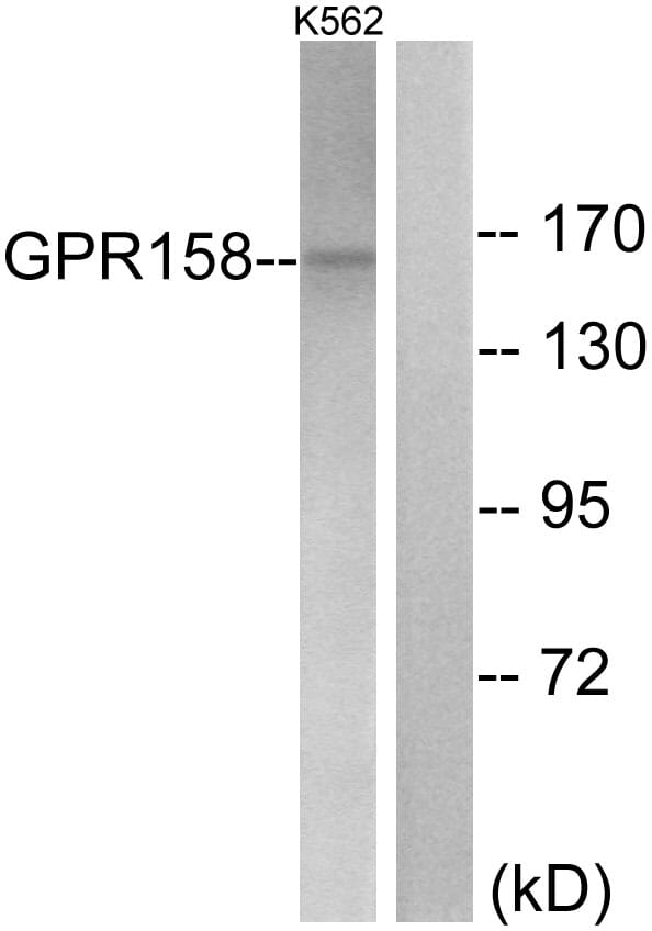 Western blot analysis of lysates from K562 cells using Anti-GPR158 Antibody. The right hand lane represents a negative control, where the antibody is blocked by the immunising peptide.