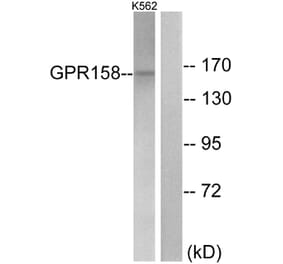 Western Blot - Anti-GPR158 Antibody (G307) - Antibodies.com