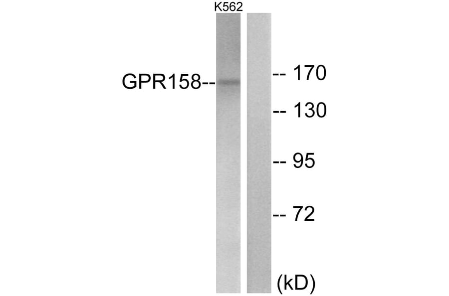 Western Blot - Anti-GPR158 Antibody (G307) - Antibodies.com