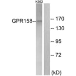 Western Blot - Anti-GPR158 Antibody (G307) - Antibodies.com