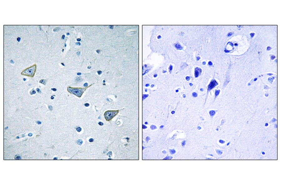 Immunohistochemistry - Anti-GPR158 Antibody (G307) - Antibodies.com