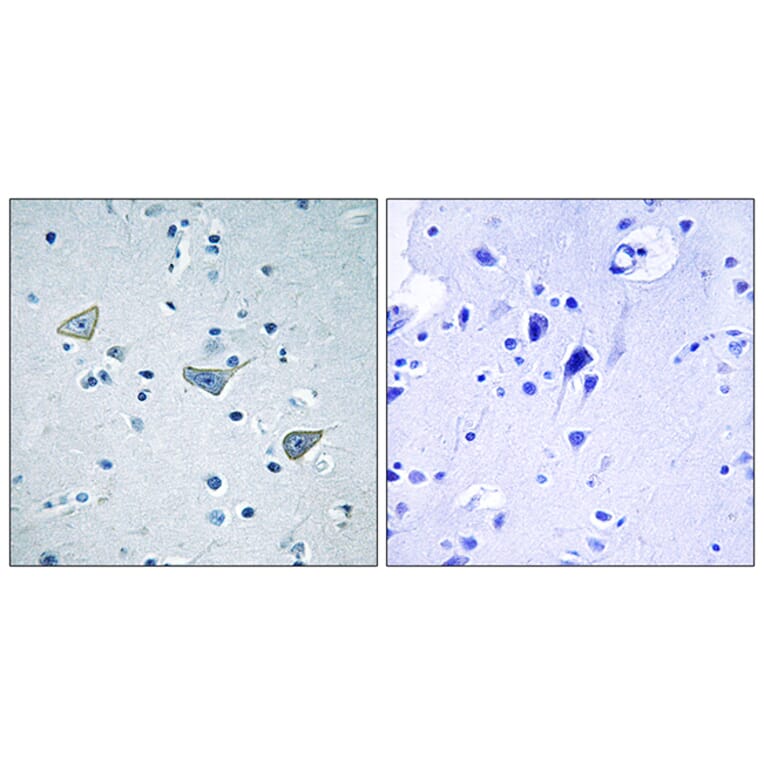 Immunohistochemistry - Anti-GPR158 Antibody (G307) - Antibodies.com