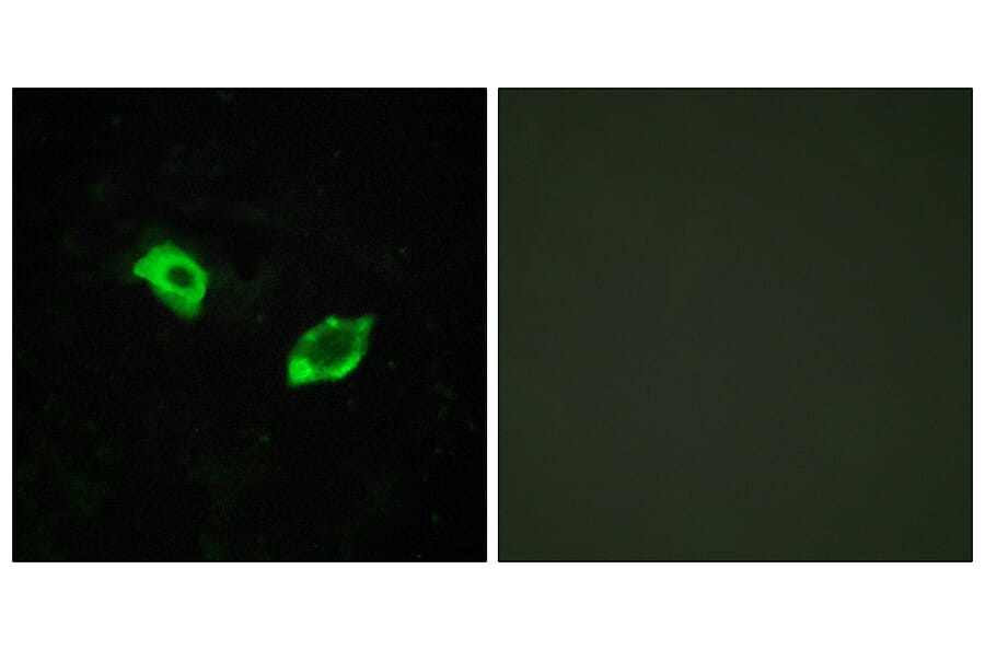 Immunofluorescence - Anti-GPR158 Antibody (G307) - Antibodies.com