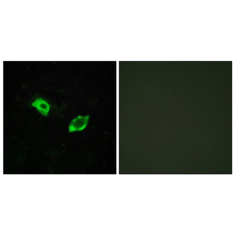 Immunofluorescence - Anti-GPR158 Antibody (G307) - Antibodies.com