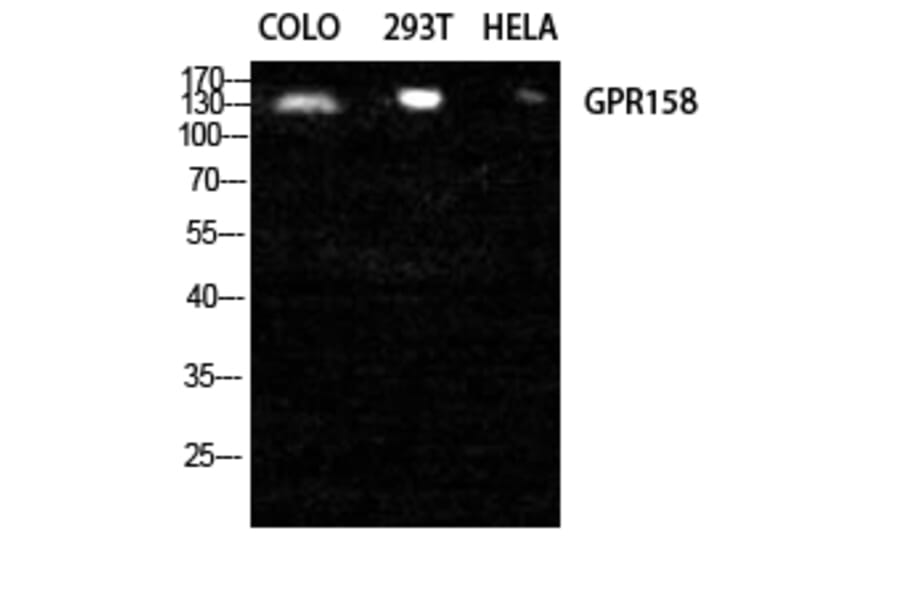 Western Blot - Anti-GPR158 Antibody (G307) - Antibodies.com